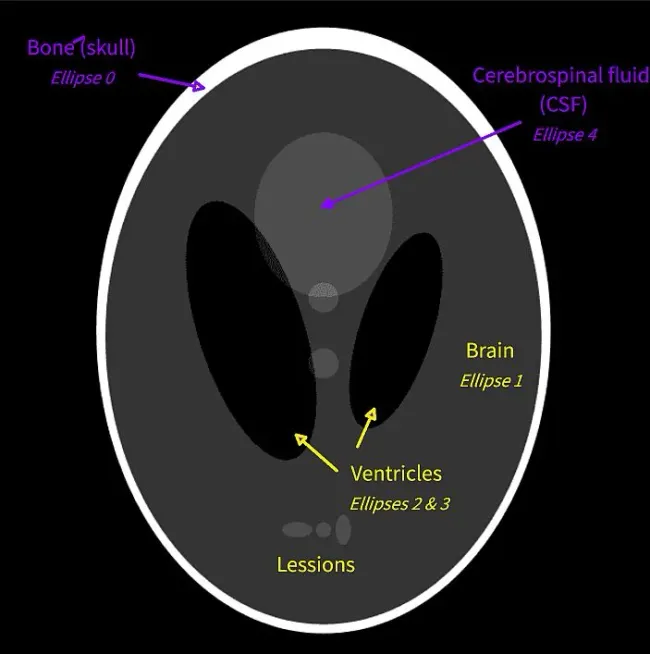 Shepp-Logan phantom model that captures the structure of a MRI scan