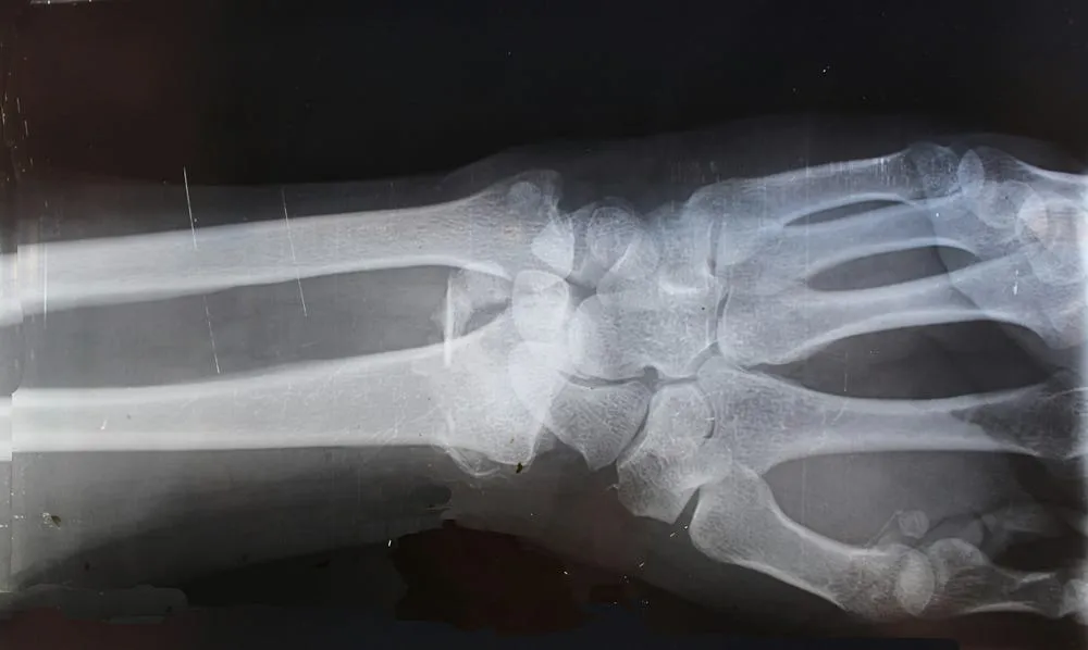 The ‘do-it-yourself’ Computed Tomography scanner
